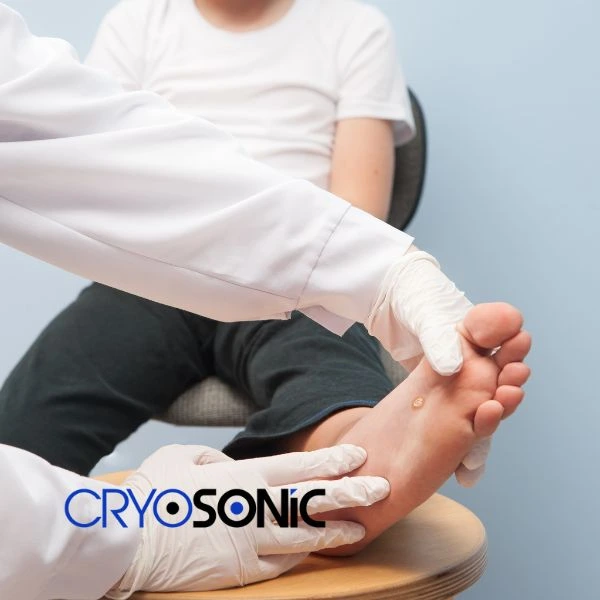Are you looking for fast effective wart removal Contact us today Bletchley